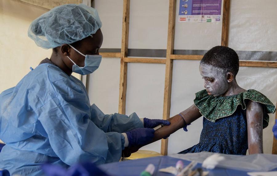 Urgence sanitaire en Afrique : L’OMS sollicite 121 millions d’euros pour maîtriser l’épidémie de Mpox