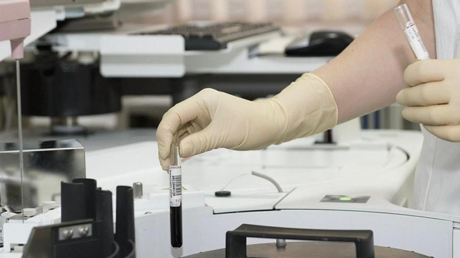 Revelando el Potencial del N-Acetil Semax Amida: Un Péptido Nootrópico de Vanguardia