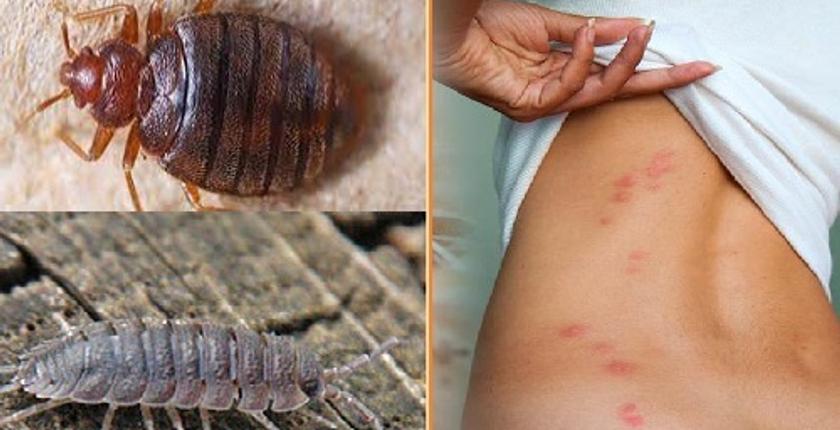 "بق الفراش".. أضراره طرق انتقاله وكيفية التخلص منه