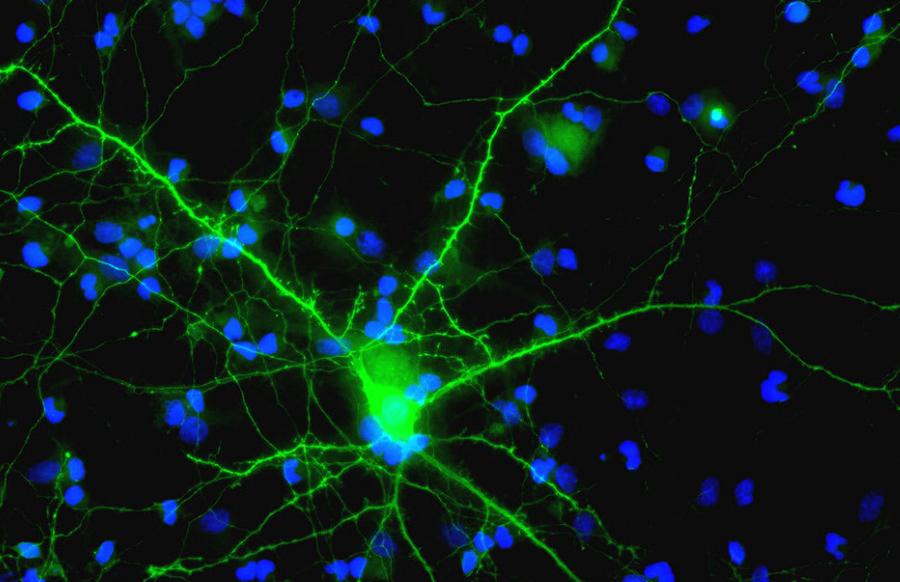 Células cerebrales vivas entrenadas para realizar tareas de aprendizaje automático