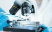 Food safety alert: Exposure to cadmium, mercury and lead remains concerning in France, says Anses
