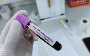 New York'ta Legionnaires hastalığı salgınına bağlı üç ölüm ve 74 vaka bildirildi