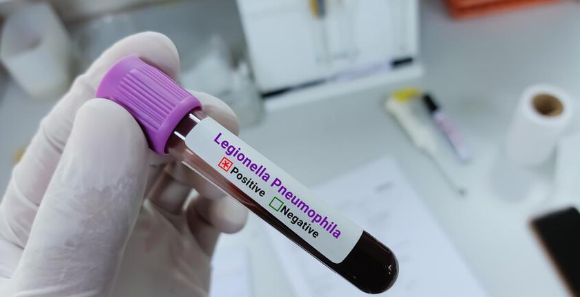 New York reports three deaths and 74 cases linked to Legionnaires’ disease outbreak