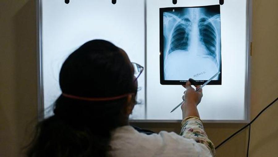 Tuberculosis case reported in Ivry-sur-Seine as contact screening is organised