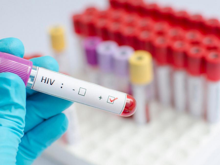 摩洛哥新艾滋病感染率下降72.4%，流行病模式发生变化