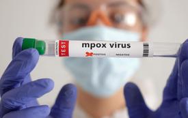 South Africa confirms 18 mpox cases as health authorities strengthen monitoring