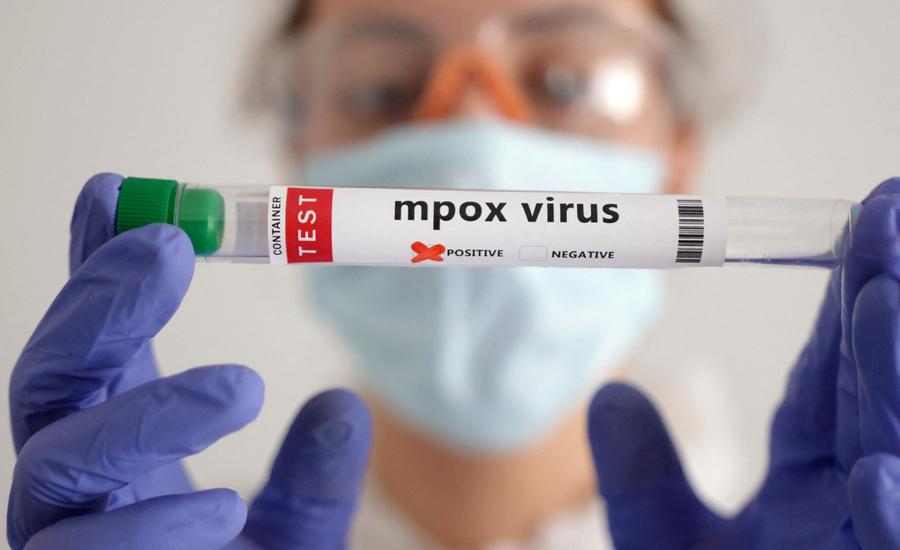 南非确认18例mpox病例，卫生部门加强监测