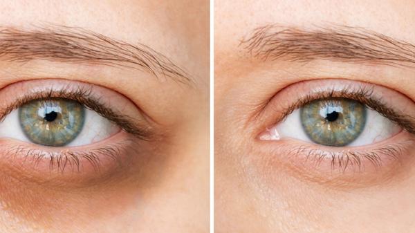Les meilleurs anti-cernes en 2026 pour un regard frais et naturel