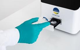 BioMérieux dévoile Spinchip, un dispositif de diagnostic rapide de l’infarctus
