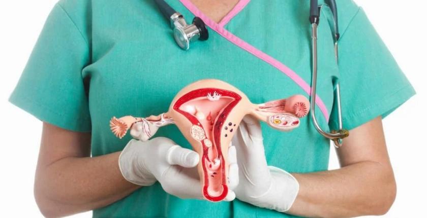 Cancer de l’ovaire au Maroc : plus de 80 % des cas diagnostiqués à un stade avancé