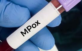 Mpox : l’Angola devient l’un des principaux foyers récents en Afrique