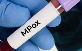 Mpox : l’Angola devient l’un des principaux foyers récents en Afrique