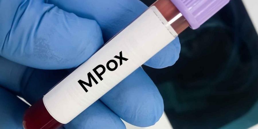 Mpox : l’Angola devient l’un des principaux foyers récents en Afrique
