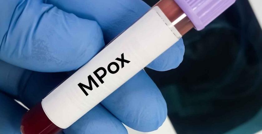 Mpox : l’Angola devient l’un des principaux foyers récents en Afrique