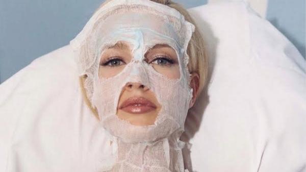 Le Botox peut-il vraiment changer notre humeur ? Ce que dit le lien entre visage et émotions