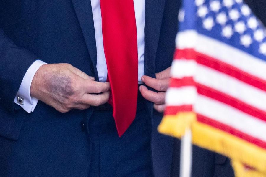 Donald Trump affirme être en parfaite santé après un nouvel examen cognitif