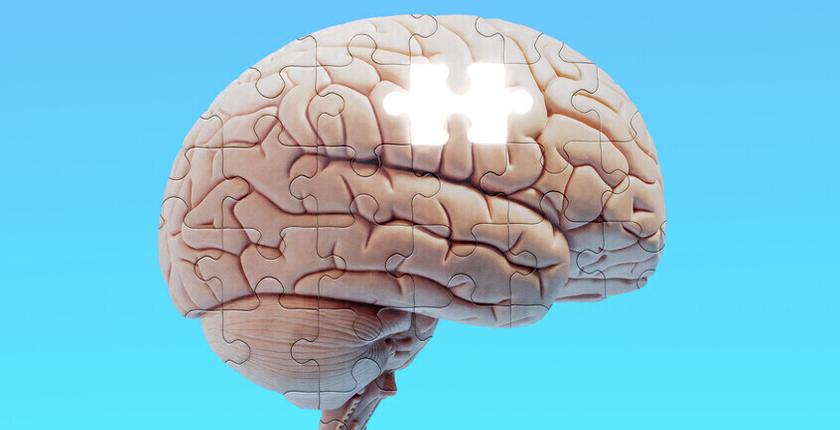 I casi di demenza globali potrebbero più che raddoppiare entro il 2050, avvertono i ricercatori