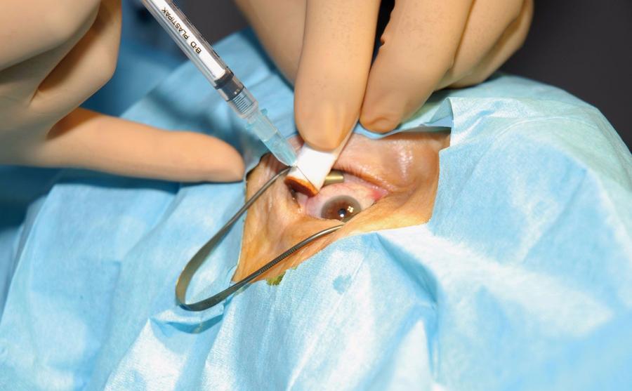 Complications oculaires à Tanger : 13 patients hospitalisés après des injections thérapeutiques