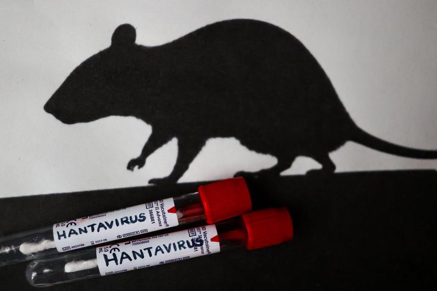 Un premier cas de hantavirus détecté au Canada : les autorités se veulent rassurantes