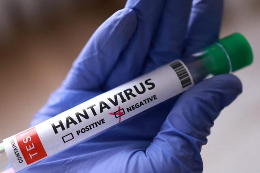 La OMS confirma resultado negativo de Hantavirus en una Azafata de KLM