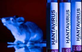 Hantavirus : entre vigilance sanitaire mondiale et résurgence des angoisses post-Covid