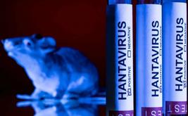 Hantavirus : entre vigilance sanitaire mondiale et résurgence des angoisses post-Covid