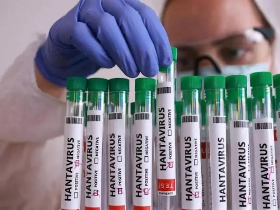 Hantavirus : le Maroc renforce les opérations de dératisation dans les ports et aéroports du Nord