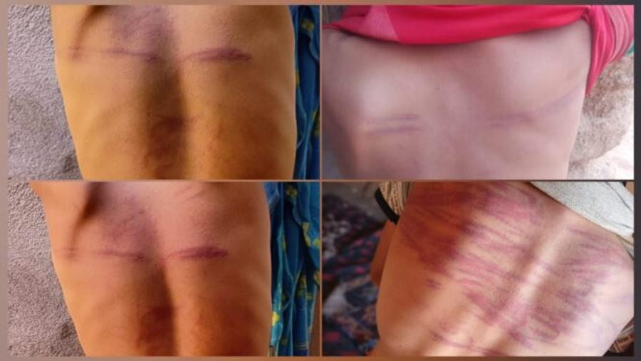 دعوات لإنصاف قاصرين تعرضوا لإعتداء بزاكورة