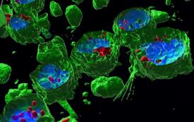 El impacto misterioso de los microplásticos en la salud: ‘los efectos a largo plazo son desconocidos’