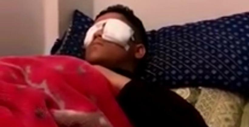 وزارة التعليم تتكفل بتلميذ انفجرت بطارية هاتفه في عينه وهو يدرس عن بعد