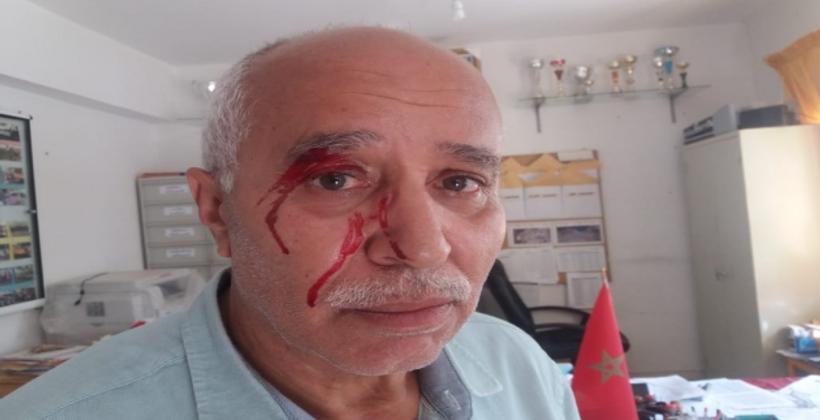 طنجة.. أم تلميذ تعتدي على مدير مدرسة وتصيبه على مستوى العين