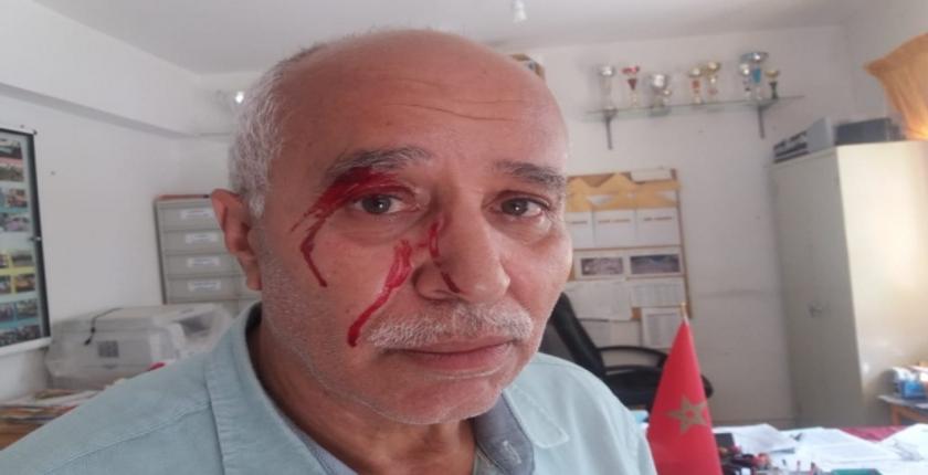 طنجة.. أم تلميذ تعتدي على مدير مدرسة وتصيبه على مستوى العين