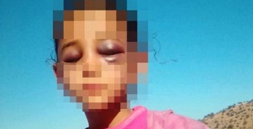 جلسة صلح لطي ملف أستاذ تارودانت المتهم بتعنيف تلميذته..