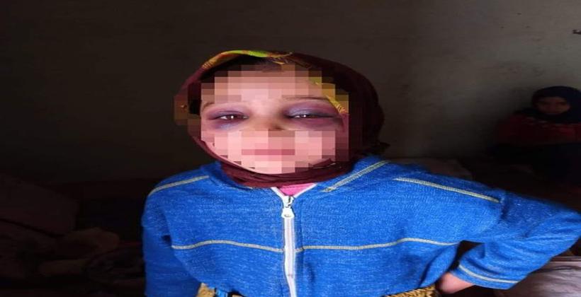 وزارة التعليم: "والدة تلميذة تارودانت هي التي عذبت إبنتها وليس أستاذها"