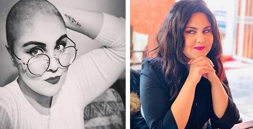 السبب الحقيقي وراء حلق الفنانة "عبير العابد" شعرها بالكامل