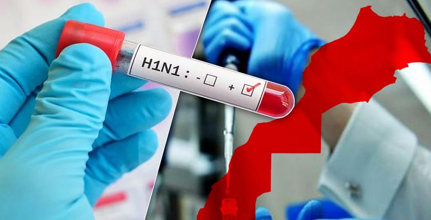 الخلفي يكشف عدد الضحايا المغاربة بسبب إنفلونزا "H1N1"