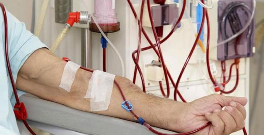بلغة الأرقام .. عدد المغاربة الذين يعانون من الفشل الكلوي 