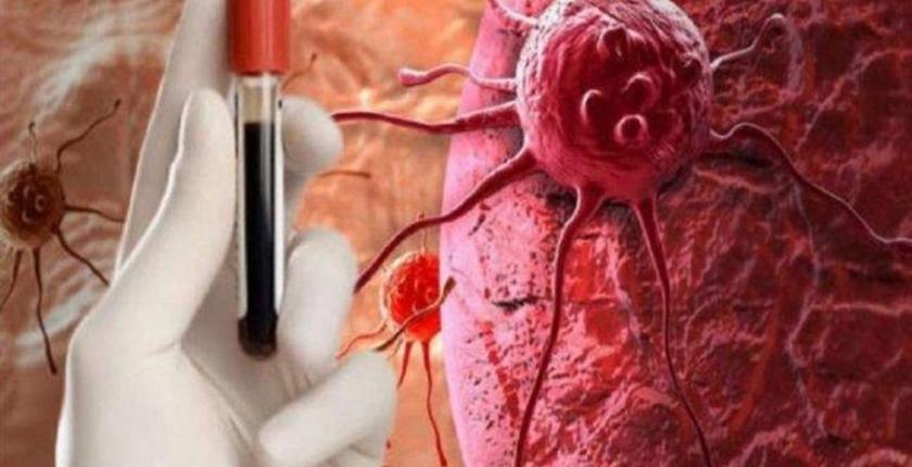 إحذر هذه العلامات .. فوجودها  يدل على الإصابة بـ"سرطان قاتل"