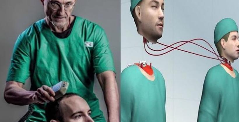 بحلول سنة 2030.. هل يمكن إجراء أول عملية زراعة لرأس بشري؟