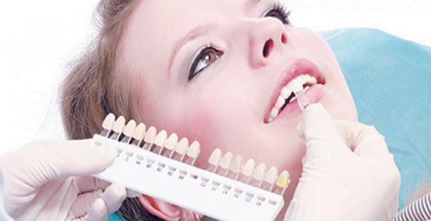العدسات اللاصقة حل أمثل لتجميل وإخفاء كسور الأنسان