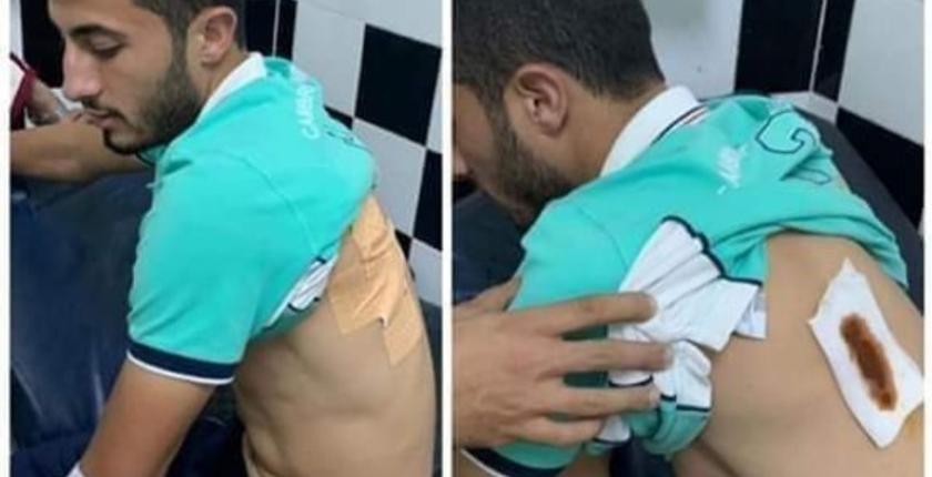 مهاجم الوداد يتعرض لطعنة غادرة قبل نهائي أبطال افريقيا