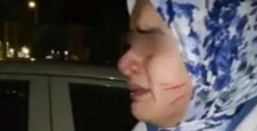 ابتدائية فاس تؤجل النظر في ملف الاعتداء على ممرضة بمصلحة السكانير 