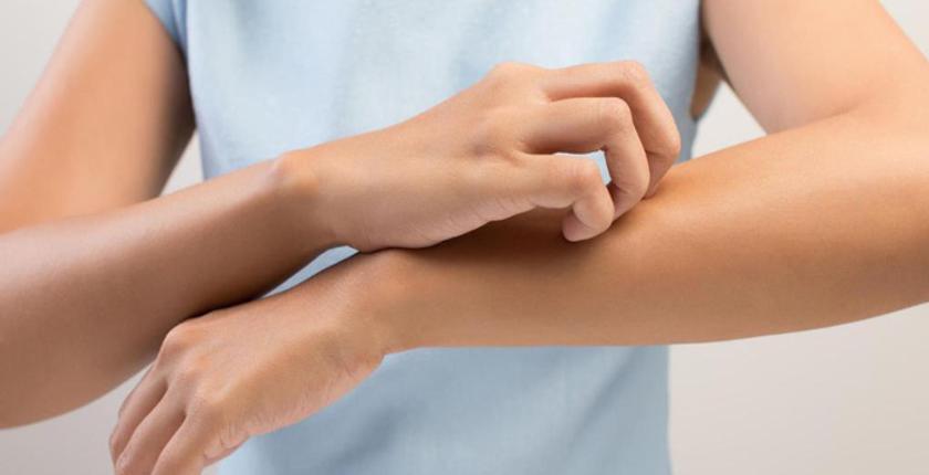 باستخدام الضوء.. علماء يتوصلون لعلاج يوقف "الحكة الجلدية"