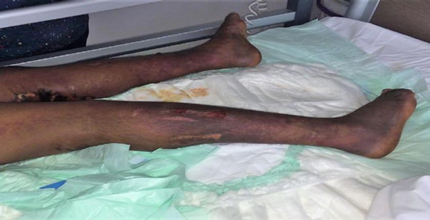 متابعة..مشغلو خادمة البيضاء يضغطون عليها من أجل التنازل